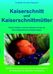 Brigitte R. Meissner: Kaiserschnitt und Kaiserschnittmütter, Buch