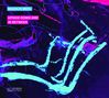 Magnus Mehl: Upside Down And In Between, CD