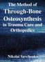 Nikolai Ivanovich Savchenko: The Method of Through-Bone Osteosynthesis in Trauma Care and Orthopedics, Buch
