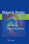 Pooya Khan Mohammad Beigi: Alopecia Areata, Buch