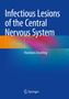 Vsevolod Zinserling: Infectious Lesions of the Central Nervous System, Buch