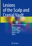 Lesions of the Scalp and Cranial Vault, Buch