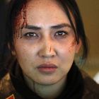 Eine Frau mit ernstem Gesichtsausdruck, blutverschmiertem Stirn und Kratzern im Gesicht, trägt eine Jacke.