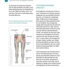 Seite 12: Ischiasbeschwerden erkennen. Diagramm zeigt Lendenwirbel, Spinalnerven, Kreuzbein, Ischias-, Wadenbein-, Schienbeinnerv.