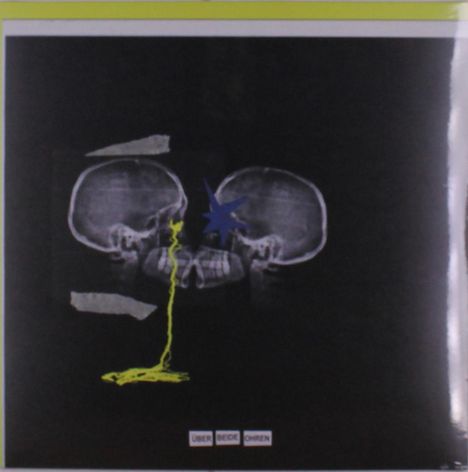 Text: "ÜBER BEIDE OHREN". Zwei Röntgenbilder von Schädeln, verbunden durch eine gelbe Linie, mit einem blauen Stern in der Mitte.