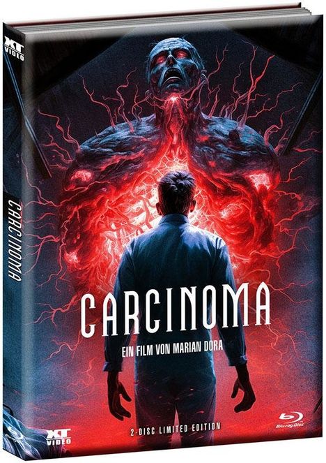 Carcinoma (Blu-ray &amp; DVD im wattierten Mediabook), 1 Blu-ray Disc und 1 DVD