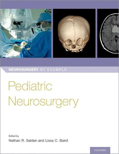Pediatric Neurosurgery, Buch
