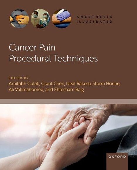 Cancer Pain Procedural Techniques, Buch