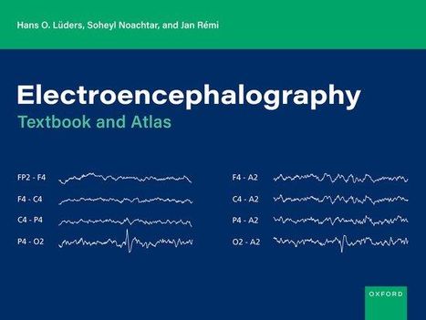 Hans O Lüders: Electroencephalography, Buch