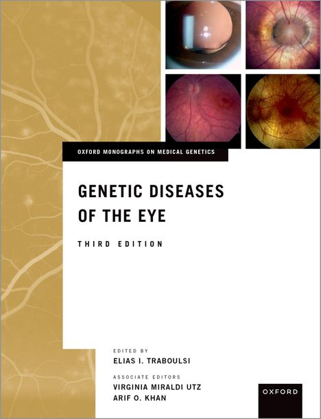 Genetic Diseases of the Eye, Buch