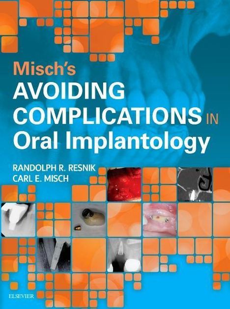 Carl E Misch: Misch's Avoiding Complications in Oral Implantology, Buch