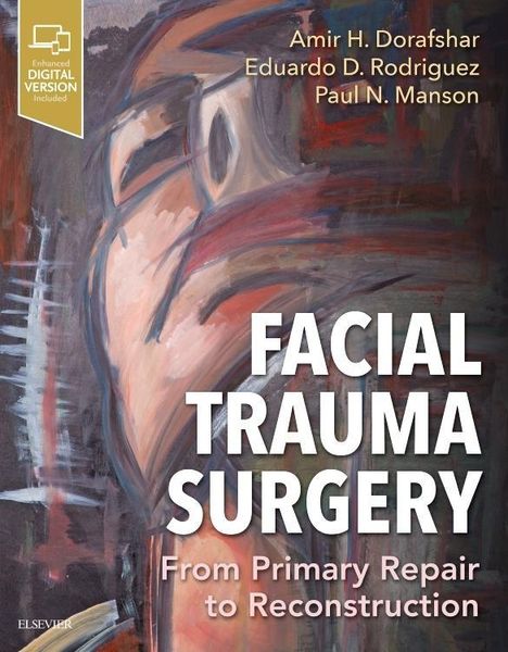 Facial Trauma Surgery, Buch