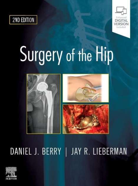 Daniel J Berry: Surgery of the Hip, Buch