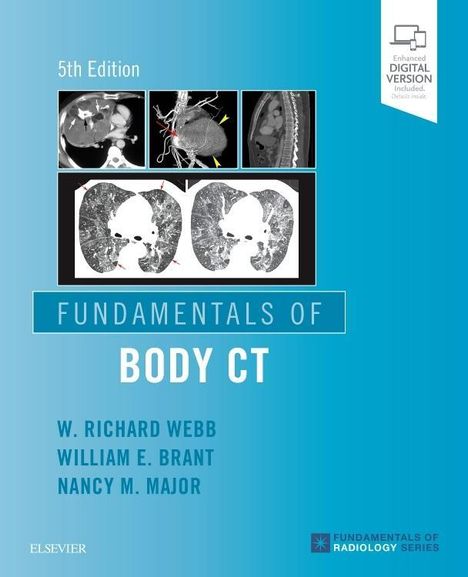 Nancy M. Major: Fundamentals of Body CT, Buch