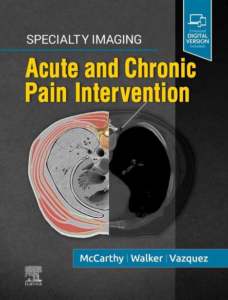 Colin J McCarthy: Specialty Imaging: Acute and Chronic Pain Intervention, Buch