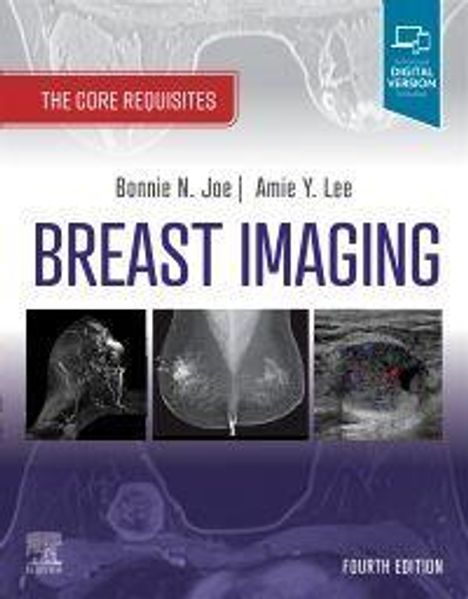 Amie Y. Lee: Breast Imaging, Buch