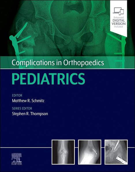 Complications in Orthopaedics: Pediatrics, Buch