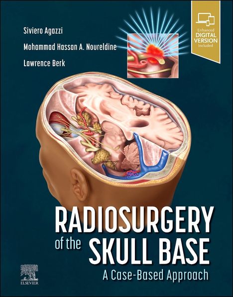 Radiosurgery of the Skull Base: A Case-Based Approach, Buch