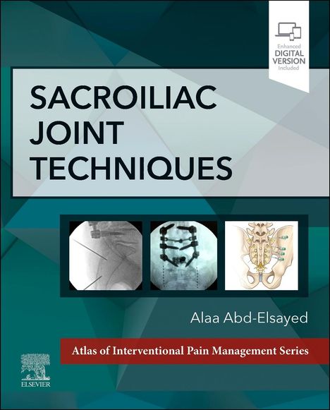 Alaa Abd-Elsayed: Sacroiliac Joint Techniques, Buch