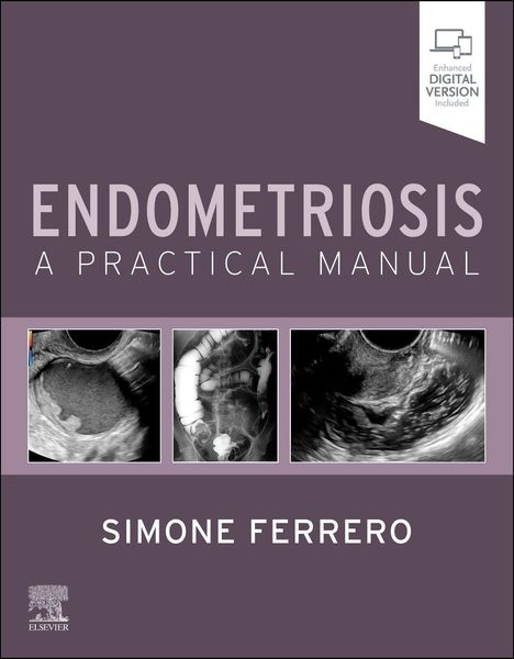 "Endometriosis: A Practical Manual", Bilder von medizinischen Scans, Name "Simone Ferrero", Logo von Elsevier unten links.