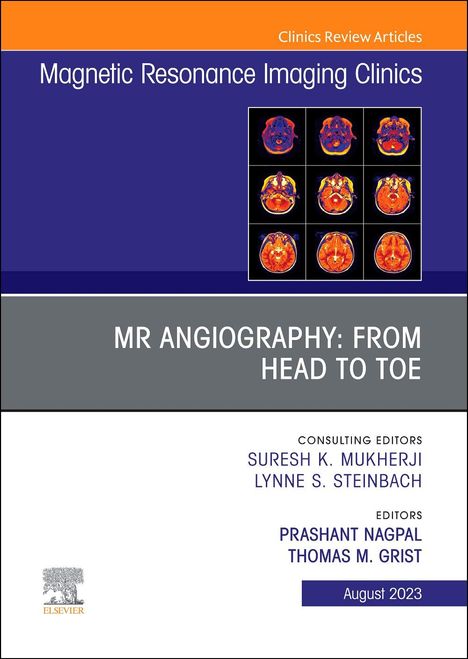 MR Angiography: From Head to Toe, an Issue of Magnetic Resonance Imaging Clinics of North America, Buch