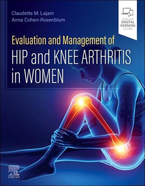 Evaluation and Management of Hip and Knee Arthritis in Women, Buch