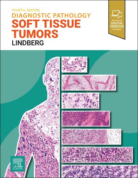 Matthew R Lindberg: Diagnostic Pathology: Soft Tissue Tumors, Buch