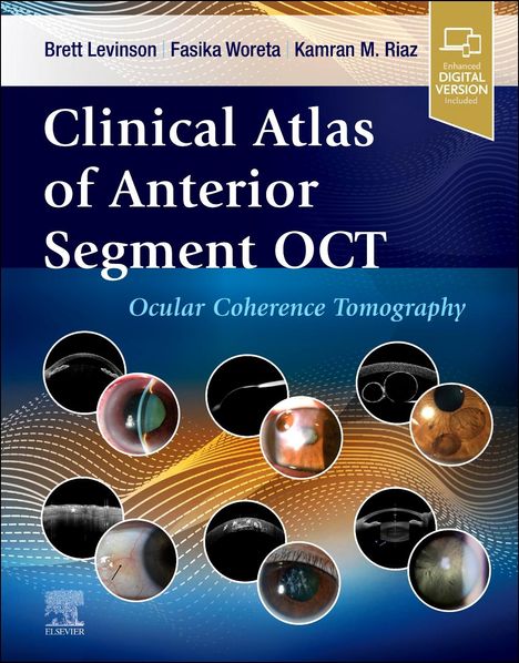 Clinical Atlas of Anterior Segment Oct: Optical Coherence Tomography, Buch