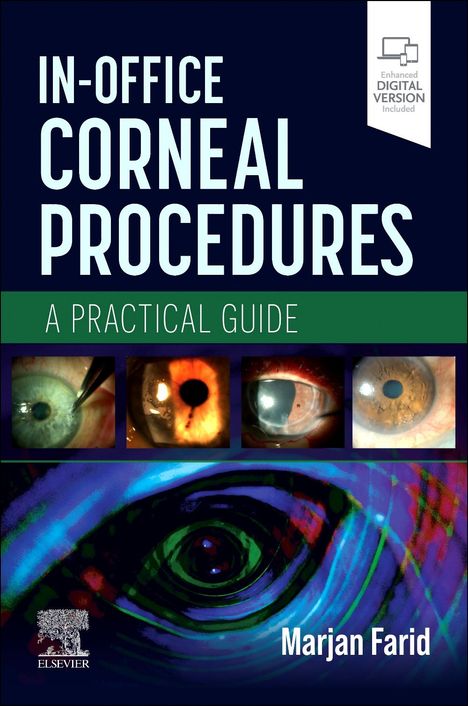 In-Office Corneal Procedures, Buch