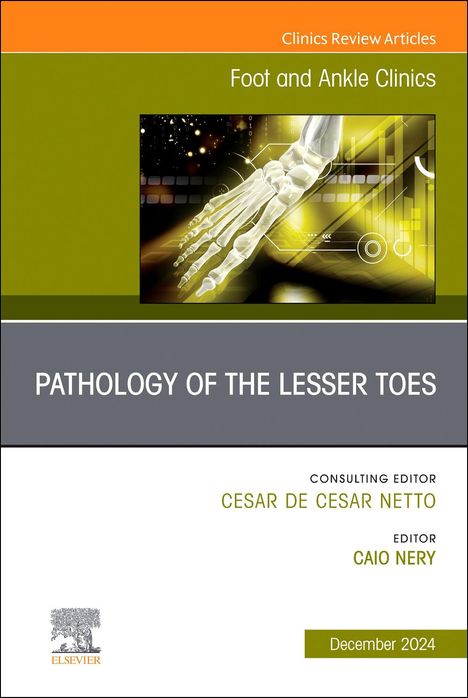 Pathology of the Lesser Toes, an Issue of Foot and Ankle Clinics of North America, Buch