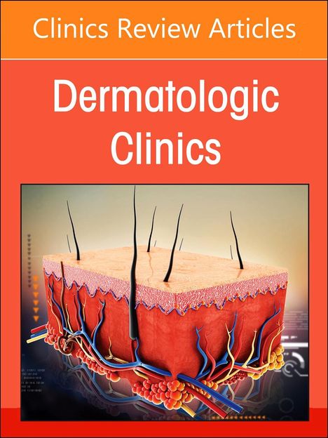 Psoriasis: Contemporary and Future Therapies, an Issue of Dermatologic Clinics, Buch