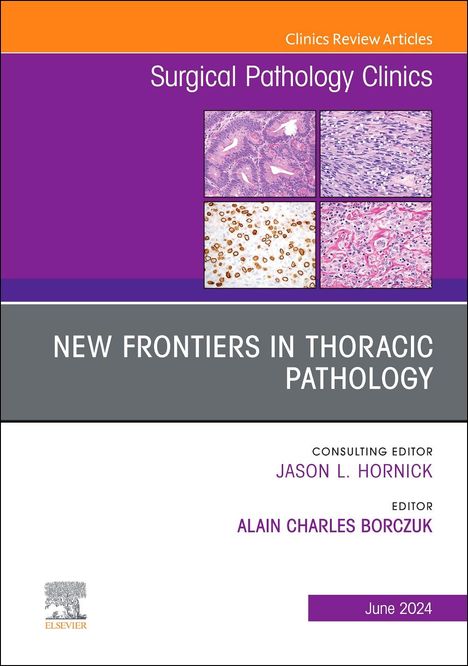 New Frontiers in Thoracic Pathology, an Issue of Surgical Pathology Clinics, Buch