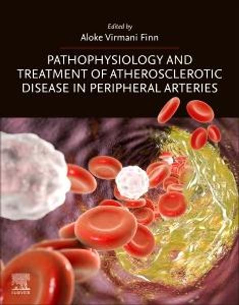 Pathophysiology and Treatment of Atherosclerotic Disease in Peripheral Arteries, Buch