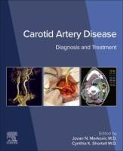 Carotid Artery Disease, Buch