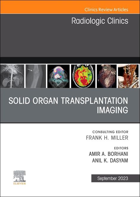 Solid Organ Transplantation Imaging, an Issue of Radiologic Clinics of North America, Buch