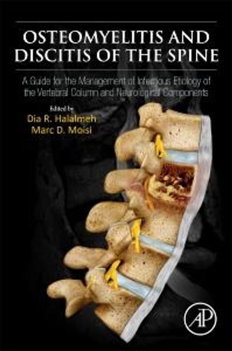 Osteomyelitis and Discitis of the Spine, Buch