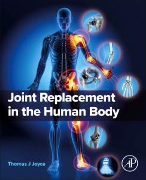 Thomas J Joyce: Joint Replacement in the Human Body, Buch