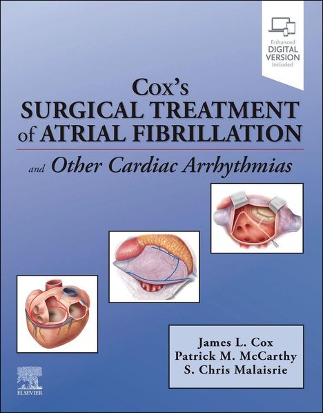 James Cox: Cox's Surgical Treatment of Atrial Fibrillation, Buch