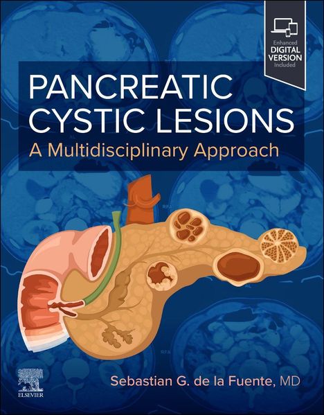 "PANCREATIC CYSTIC LESIONS: A Multidisciplinary Approach" von Sebastian G. de la Fuente, MD. Illustrationen der Bauchspeicheldrüse.