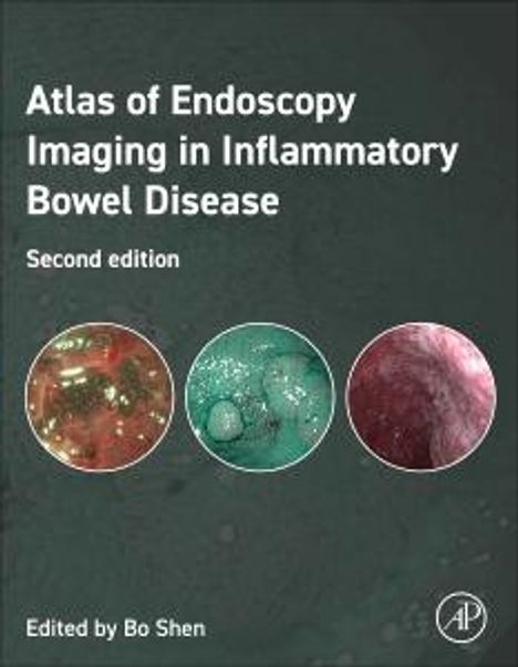 Bo Shen: Atlas of Endoscopy Imaging in Inflammatory Bowel Disease, Buch