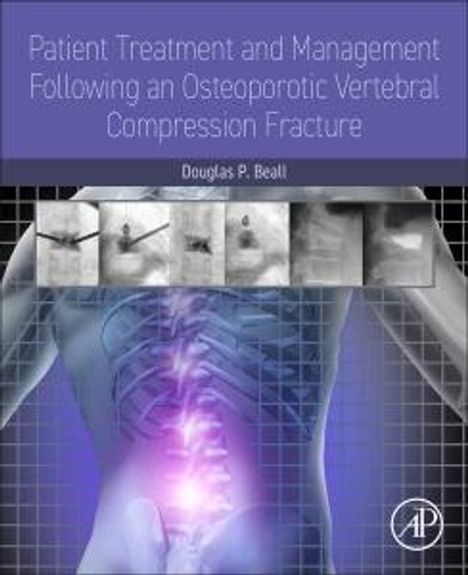 "Patient Treatment and Management Following an Osteoporotic Vertebral Compression Fracture" von Douglas P. Beall. Illustration: Wirbelsäule.