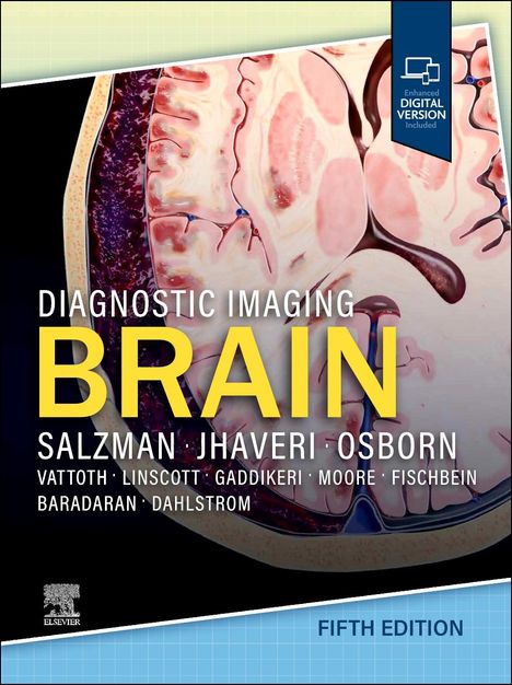 Miral D Jhaveri: Diagnostic Imaging: Brain, Buch
