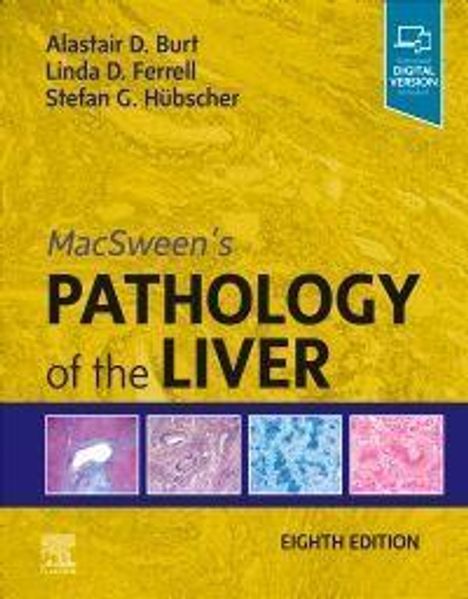 Alastair D Burt: Macsween's Pathology of the Liver, Buch