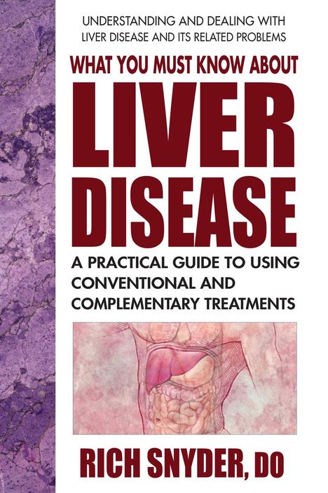 Rich Snyder: What You Must Know about Liver Disease, Buch