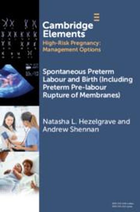 Andrew Shennan: Spontaneous Preterm Labour and Birth (Including Preterm Pre-labour Rupture of Membranes), Buch