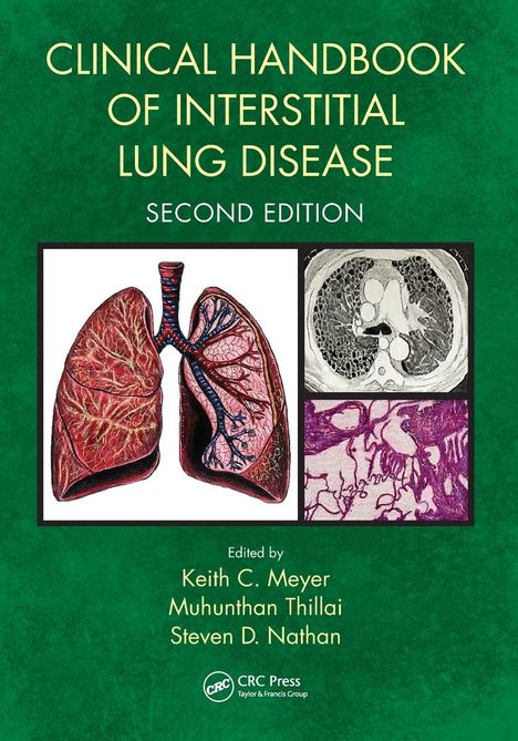 "CLINICAL HANDBOOK OF INTERSTITIAL LUNG DISEASE SECOND EDITION" steht in großen, gelben Buchstaben auf grünem Hintergrund. Illustrationen von Lungen im Mittelpunkt.