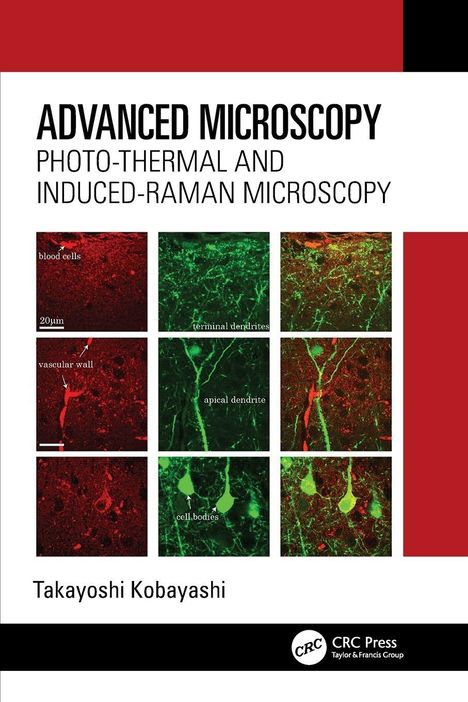 Titel: Advanced Microscopy. Text: blood cells, terminal dendrites, vascular wall, apical dendrite, cell bodies. Mikroskopische Bilder.