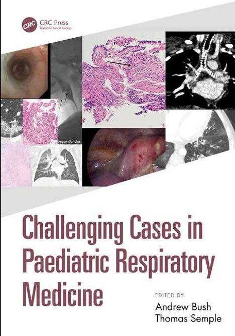 Texte: "Challenging Cases in Paediatric Respiratory Medicine." "Edited by Andrew Bush, Thomas Semple." Collage aus medizinischen Bildern.