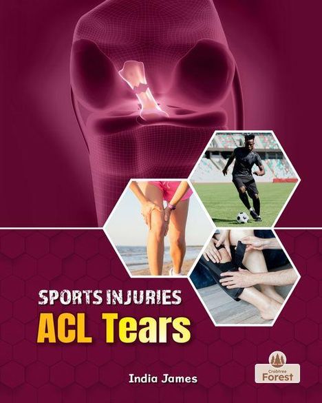 "SPORTS INJURIES: ACL Tears" steht auf einem Cover mit Sportbildern und einem Logo.