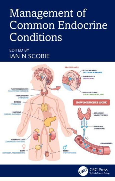 "Management of Common Endocrine Conditions" von Ian N. Scobie. Illustration der endokrinen Drüsen im menschlichen Körper.